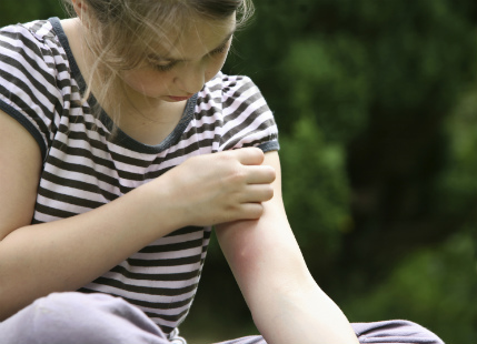 6 Ways Mosquitoes Affect Your Day To Day Life